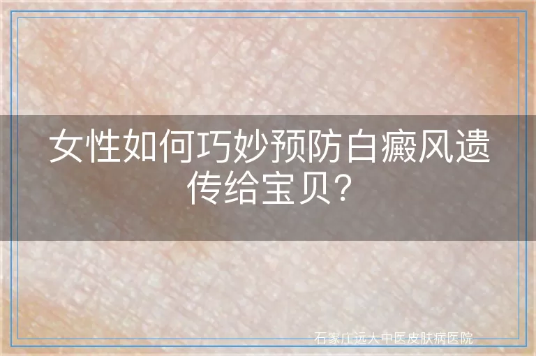 女性如何巧妙预防白癜风遗传给宝贝？