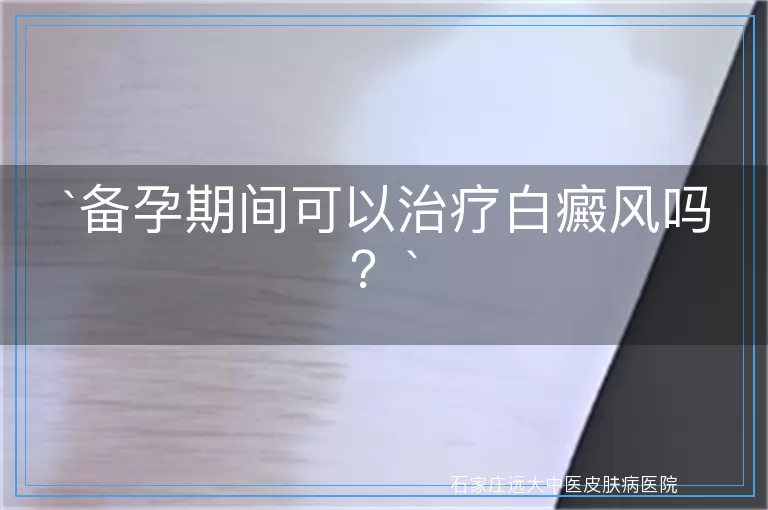 备孕期间可以治疗白癜风吗？