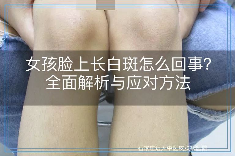 女孩脸上长白斑怎么回事?全面解析与应对方法