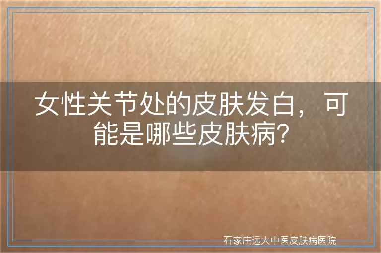 女性关节处的皮肤发白,可能是哪些皮肤病?