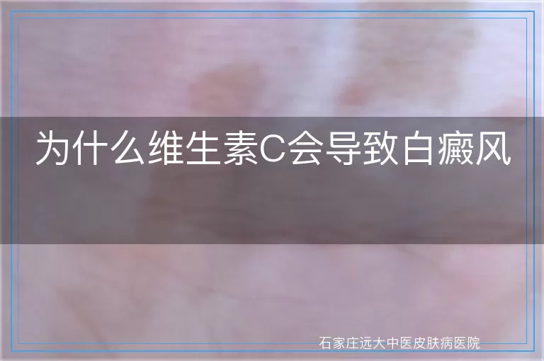 为什么维生素C会导致白癜风
