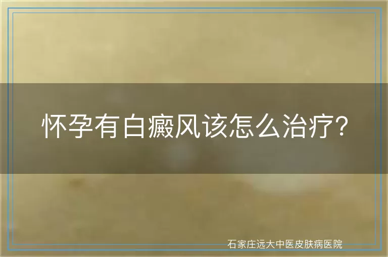 怀孕有白癜风该怎么治疗？