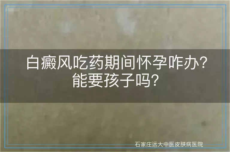 白癜风吃药期间怀孕咋办?能要孩子吗?