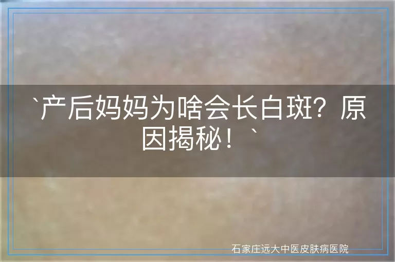 产后妈妈为啥会长白斑？原因揭秘！
