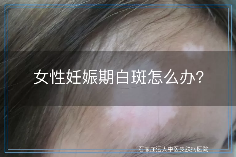 女性妊娠期白斑怎么办？