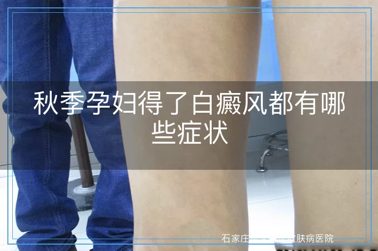 秋季孕妇得了白癜风都有哪些症状