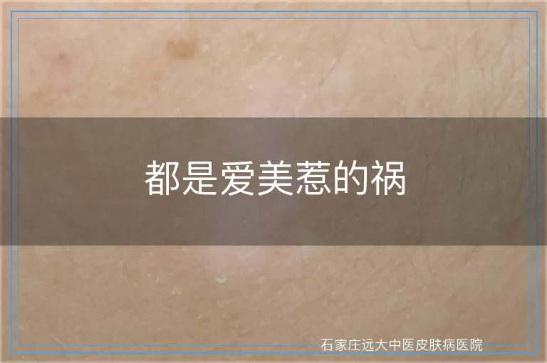 都是爱美惹的祸