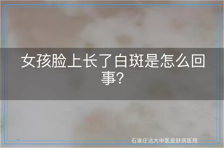 女孩脸上长了白斑是怎么回事?