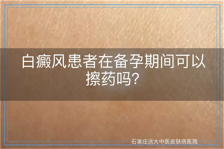 白癜风患者在备孕期间可以擦药吗？
