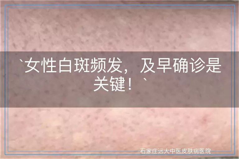 女性白斑频发，及早确诊是关键！