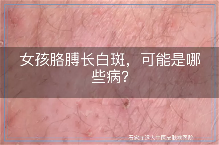 女孩胳膊长白斑，可能是哪些病？