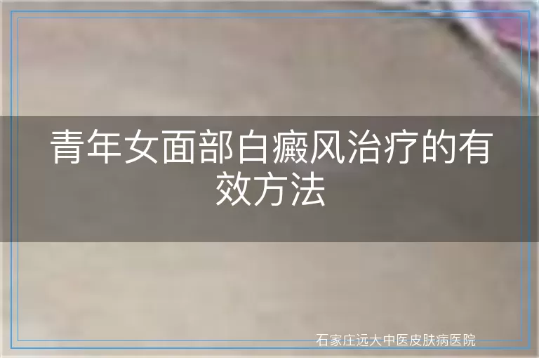 青年女面部白癜风治疗的有效方法