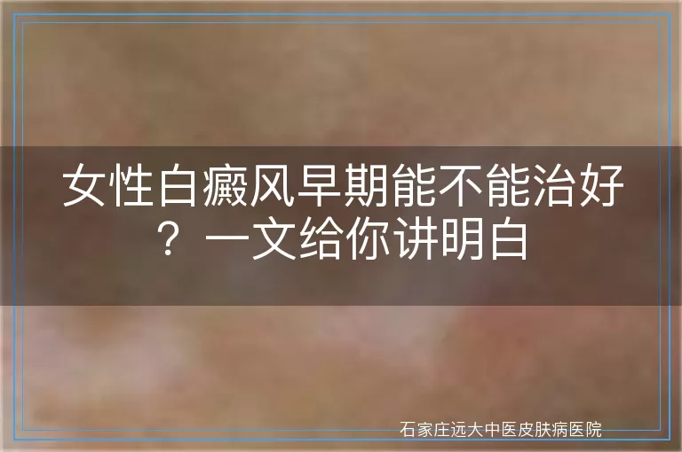 女性白癜风早期能不能治好？一文给你讲明白