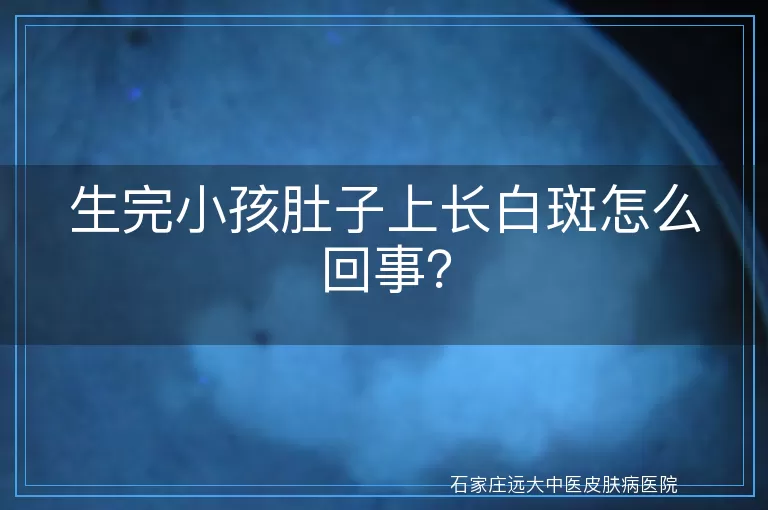 生完小孩肚子上长白斑怎么回事?