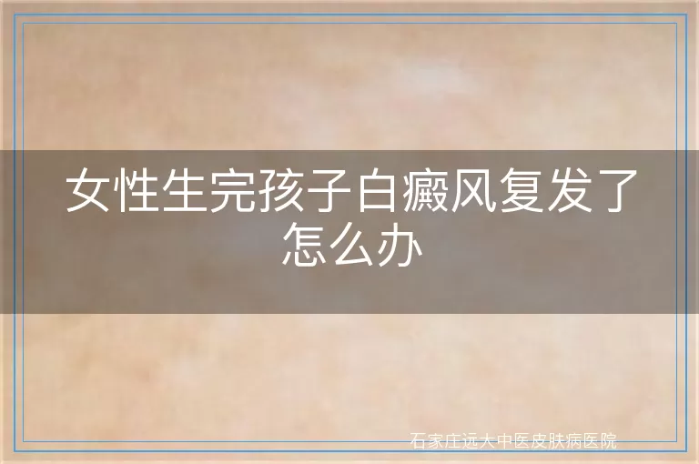 女性生完孩子白癜风复发了怎么办