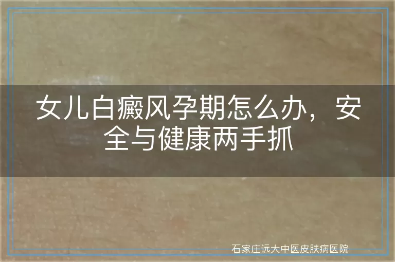 女儿白癜风孕期怎么办，安全与健康两手抓