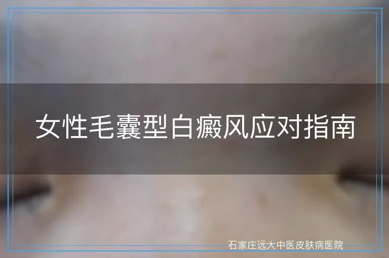 女性毛囊型白癜风应对指南