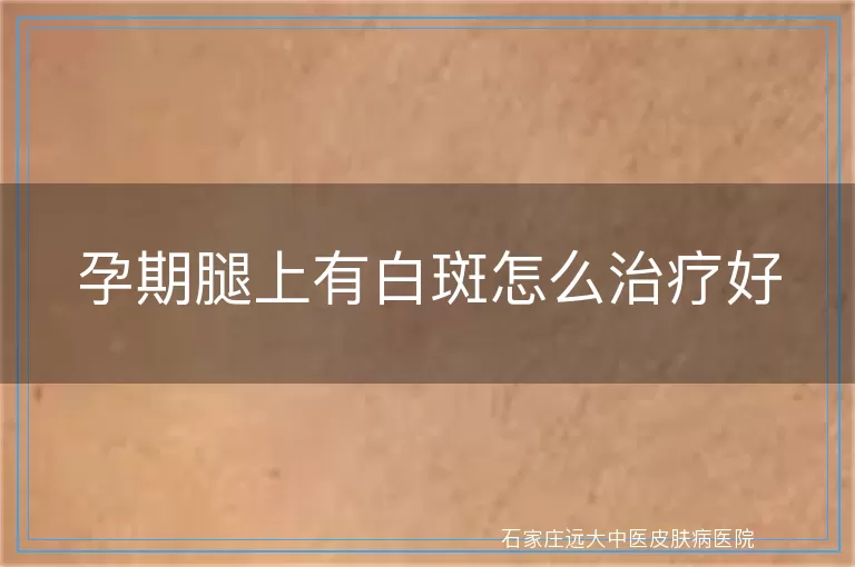 孕期腿上有白斑怎么治疗好