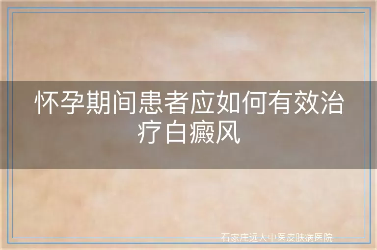 怀孕期间患者应如何有效治疗白癜风