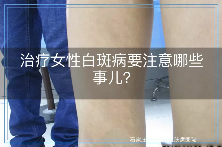 治疗女性白斑病要注意哪些事儿？