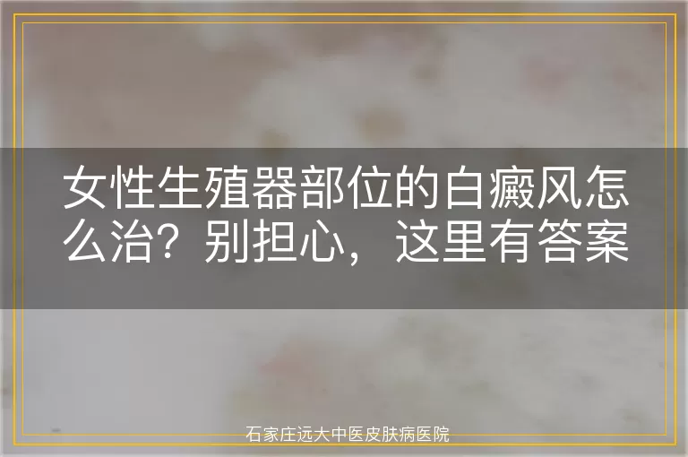 女性生殖器部位的白癜风怎么治？别担心，这里有答案！