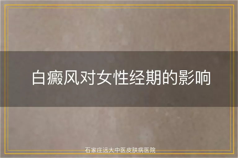 白癜风对女性经期的影响