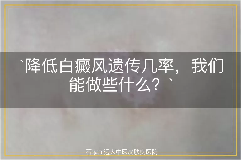 降低白癜风遗传几率，我们能做些什么？