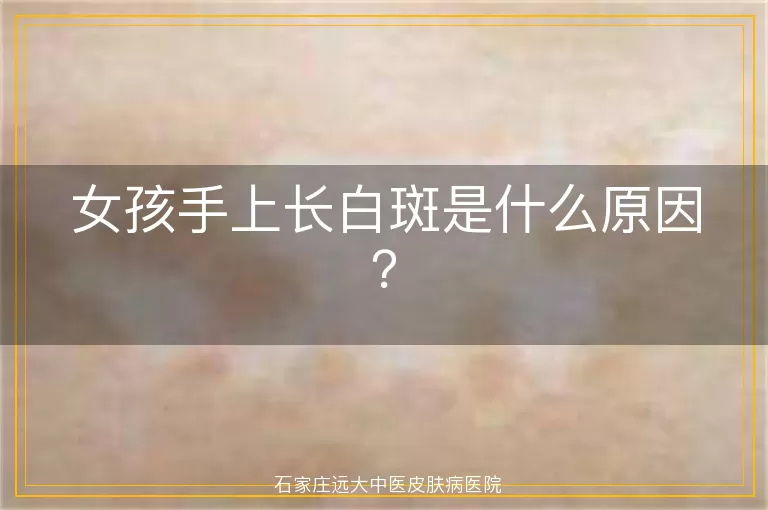 女孩手上长白斑是什么原因？