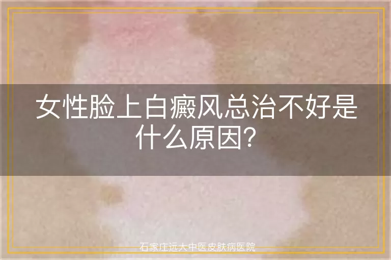 女性脸上白癜风总治不好是什么原因？
