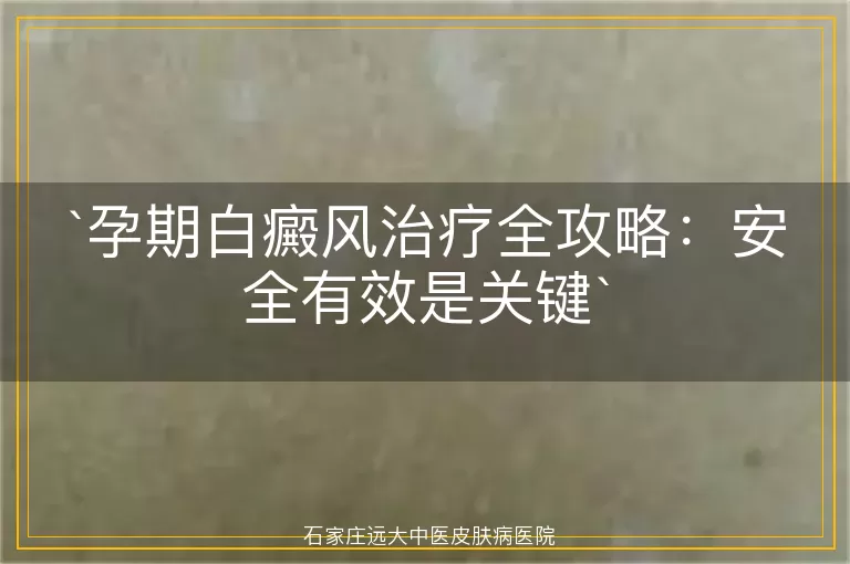 孕期白癜风治疗全攻略:安全有效是关键