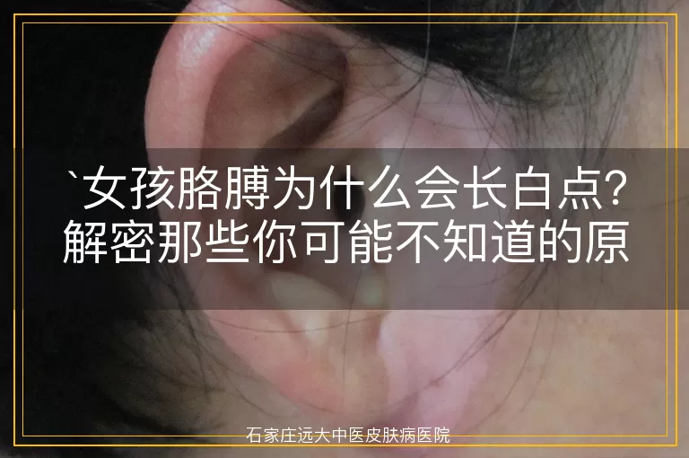 女孩胳膊为什么会长白点？解密那些你可能不知道的原因