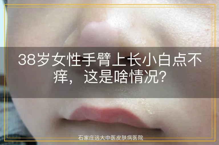 38岁女性手臂上长小白点不痒，这是啥情况？