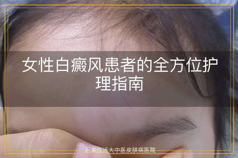 女性白癜风患者的全方位护理指南