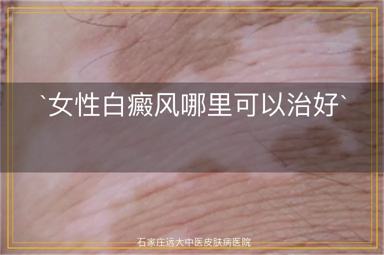 女性白癜风哪里可以治好