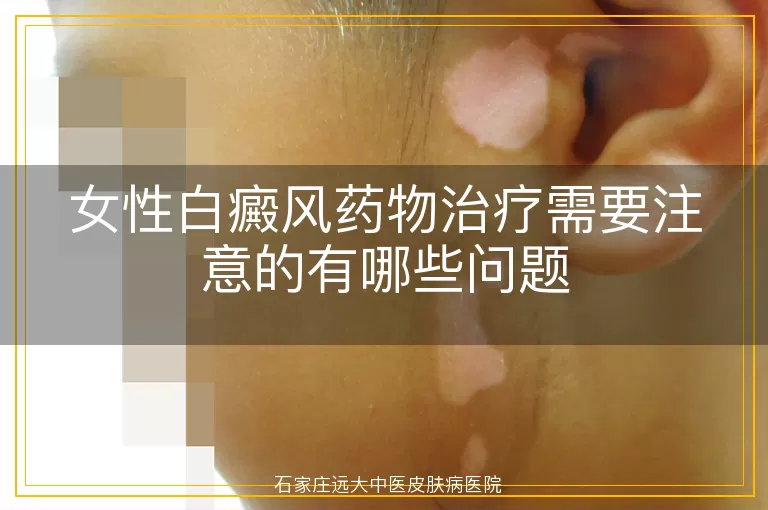 女性白癜风药物治疗需要注意的有哪些问题