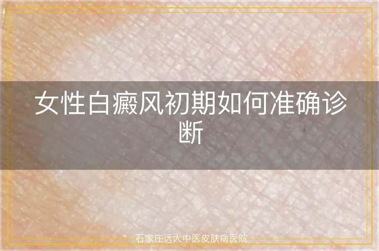 女性白癜风初期如何准确诊断