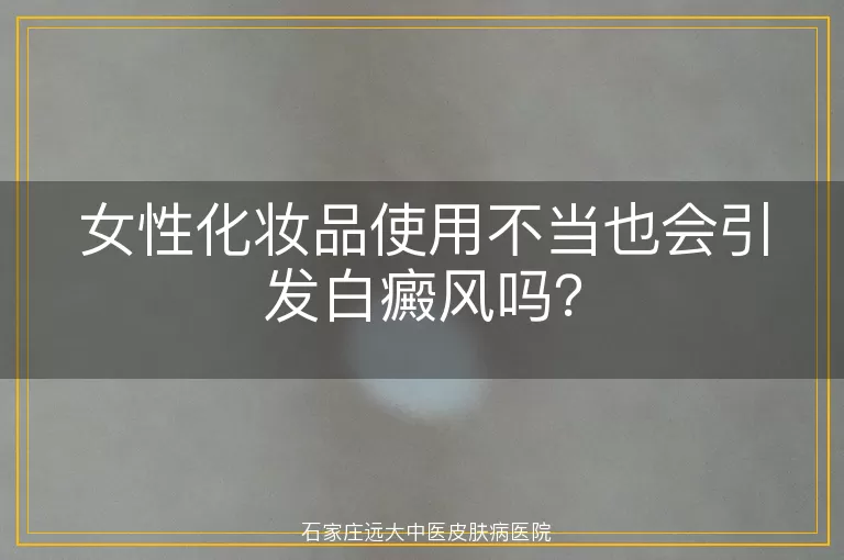 女性化妆品使用不当也会引发白癜风吗？