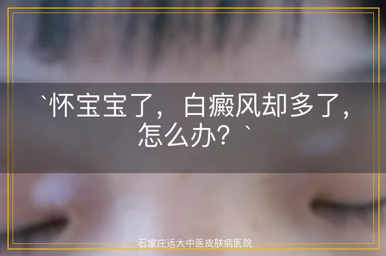 怀宝宝了，白癜风却多了，怎么办？