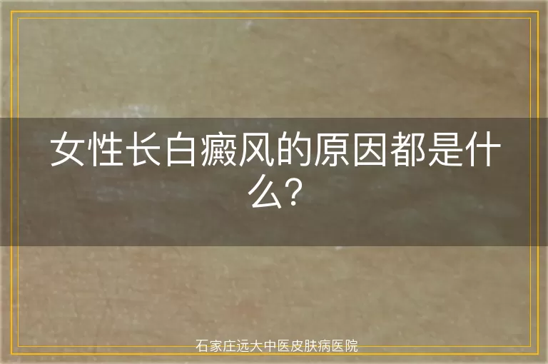 女性长白癜风的原因都是什么？