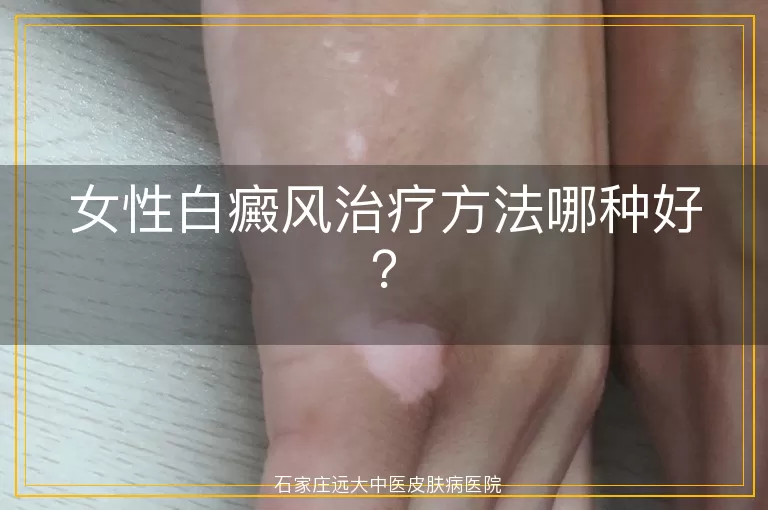 女性白癜风治疗方法哪种好？