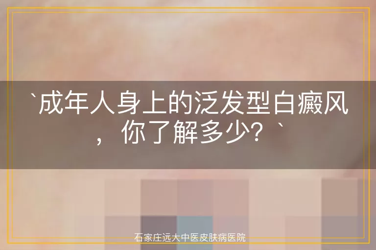 成年人身上的泛发型白癜风，你了解多少？