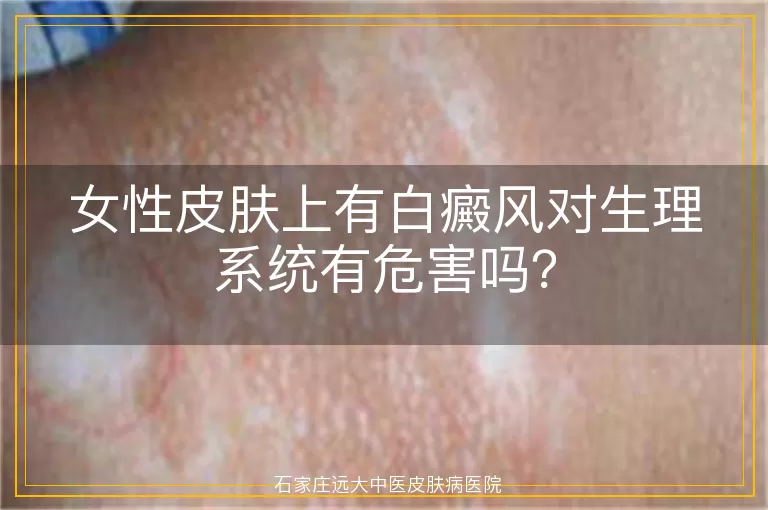 女性皮肤上有白癜风对生理系统有危害吗？