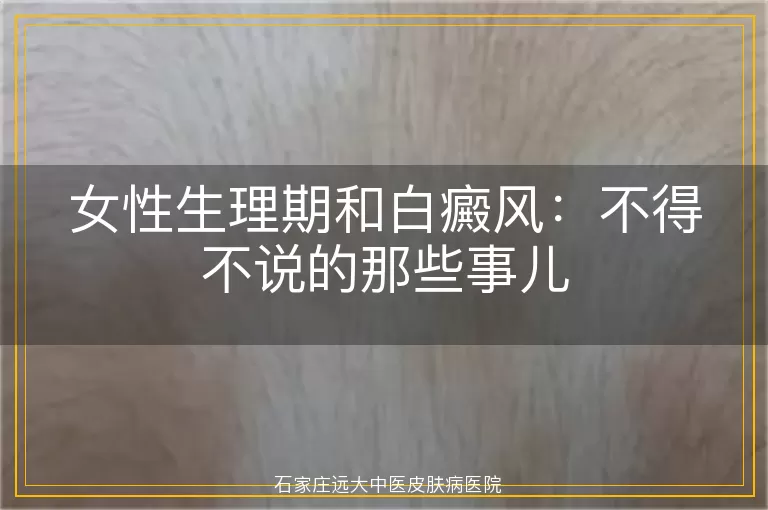 女性生理期和白癜风：不得不说的那些事儿