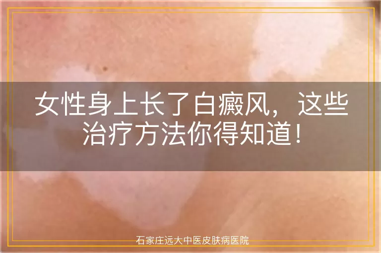 女性身上长了白癜风，这些治疗方法你得知道！