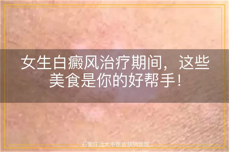 女生白癜风治疗期间，这些美食是你的好帮手！