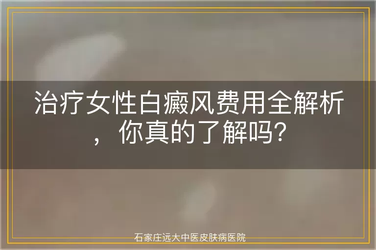 治疗女性白癜风费用全解析，你真的了解吗？