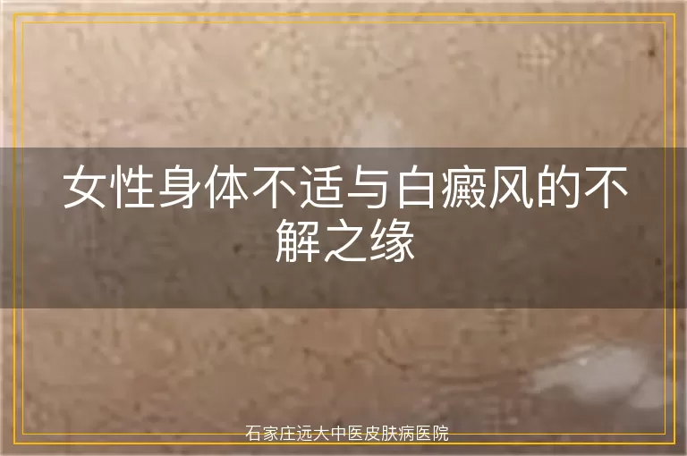 女性身体不适与白癜风的不解之缘
