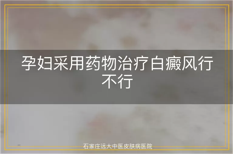 孕妇采用药物治疗白癜风行不行