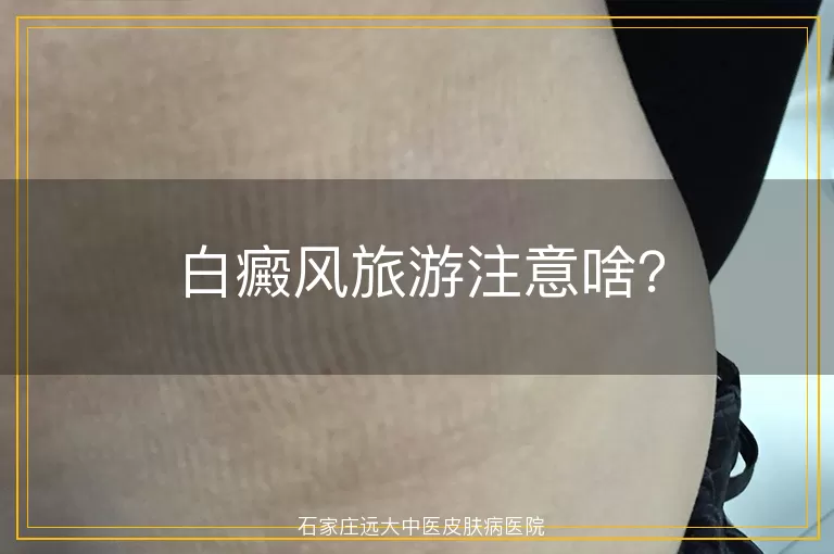 白癜风旅游注意啥？