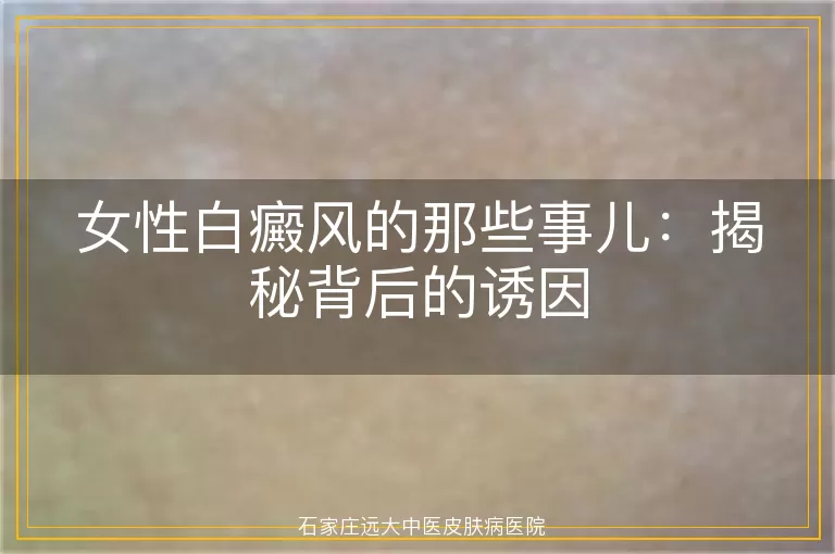 女性白癜风的那些事儿：揭秘背后的诱因